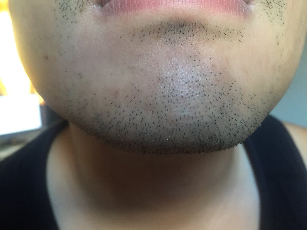 before-shave-2.jpg
