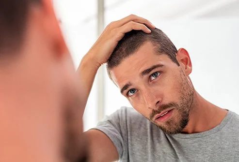 20 ways to stop hair loss in men