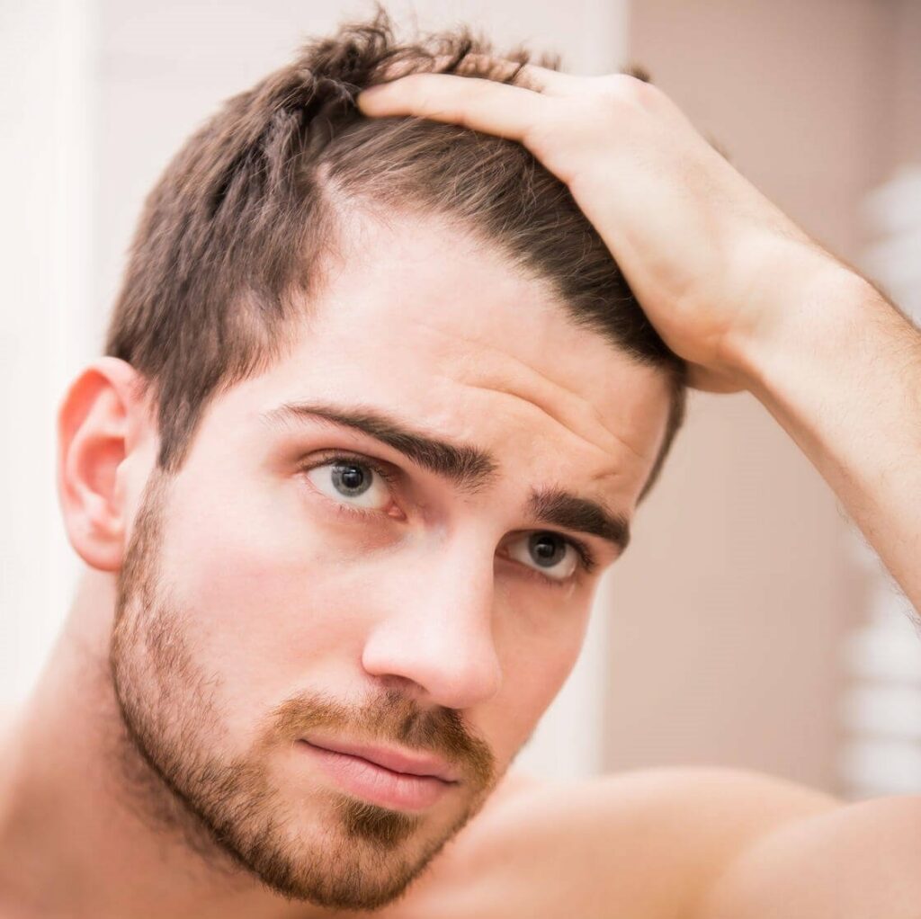 Cure For Male Pattern Baldness 1