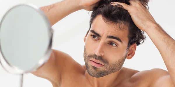 Male Hair Loss 1