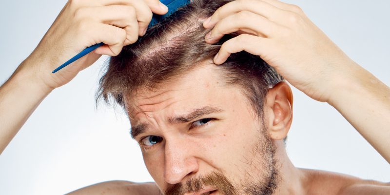Vitamin D deficiency can be found by testing human hair - The Week