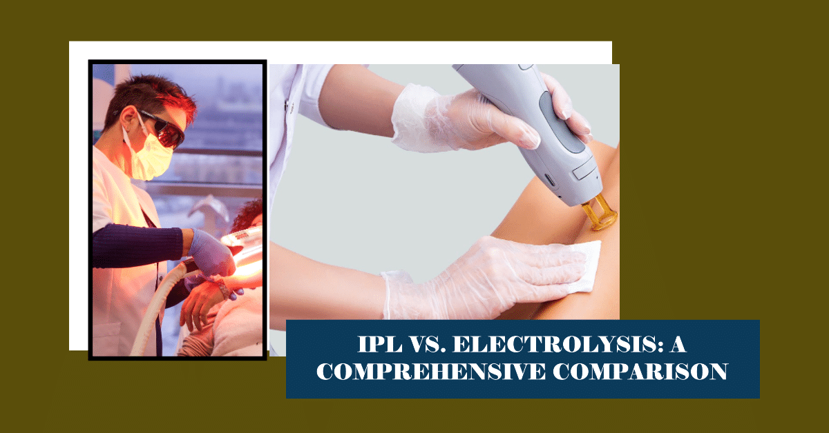 IPL Vs. Electrolysis