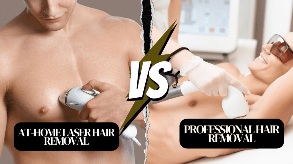 At-Home Vs. Professional Laser Hair Removal